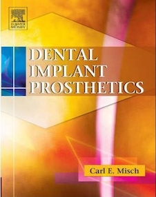 عکس Dental Implant Prosthetics