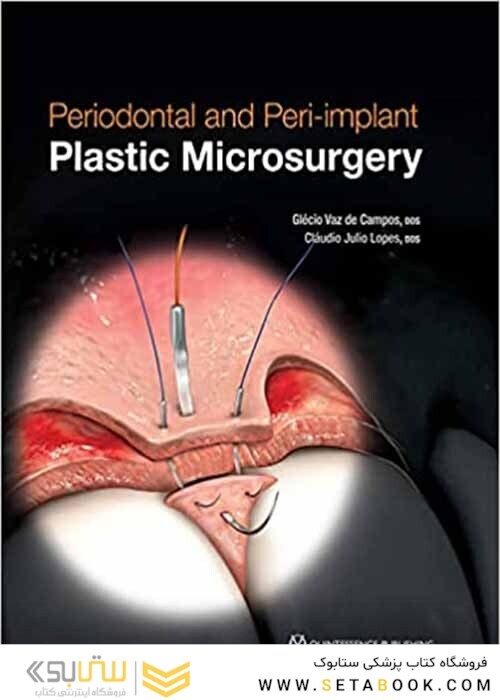 Periodontal and Peri-implant Plastic Microsurgery: Minimally Invasive Techniques with Maximum Precision