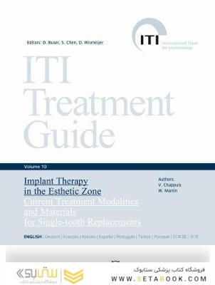 ITI Treatment Guide, Volume 10: Implant Therapy in the Esthetic Zone : Current Treatment Modalities and Materials for Single-tooth Replacements
