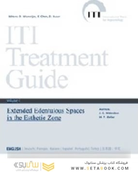ITI Treatment Guide: Extended Edentulous Spaces in the Esthetic Zone 6