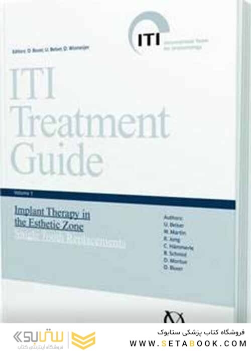 ITI Treatment Guide: Implant Therapy in the Esthetic Zone - Single-tooth Replacements v. 1