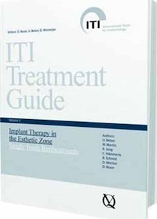 عکس ITI Treatment Guide: Implant Therapy in the Esthetic Zone - Single-tooth Replacements v. 1