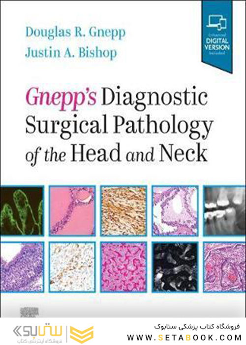 Gnepp