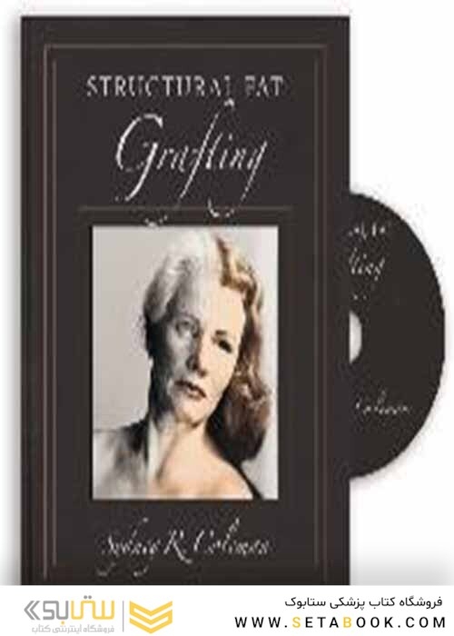 Structural Fat Grafting