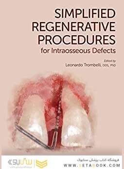 Simplified Regenerative Procedures for Intraosseous Defects