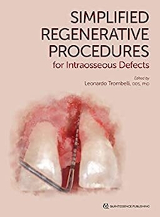 عکس Simplified Regenerative Procedures for Intraosseous Defects