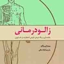 زالو درمانی