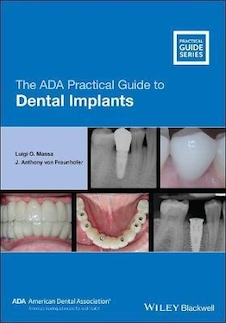 عکس The ADA Practical Guide to Dental Implants 2021