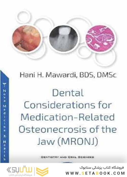 Dental Considerations for Medication-Related Osteonecrosis of the Jaw (MRONJ)