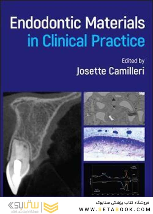 Endodontic Materials in Clinical Practice