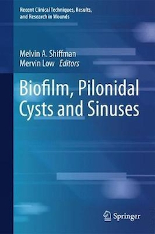 عکس Biofilm, Pilonidal Cysts and Sinuses