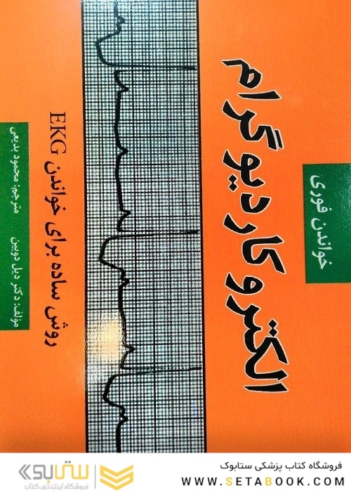 خواندن فوری الکتروکاردیوگرام (EKG)