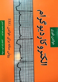 عکس خواندن فوری الکتروکاردیوگرام (EKG)