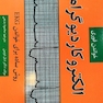 خواندن فوری الکتروکاردیوگرام (EKG)