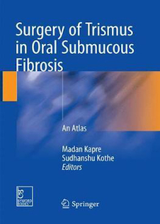 عکس Surgery of Trismus in Oral Submucous Fibrosis