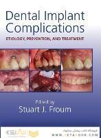 Dental Implant Complications