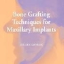 Bone Grafting Techniques for Maxillary Implants