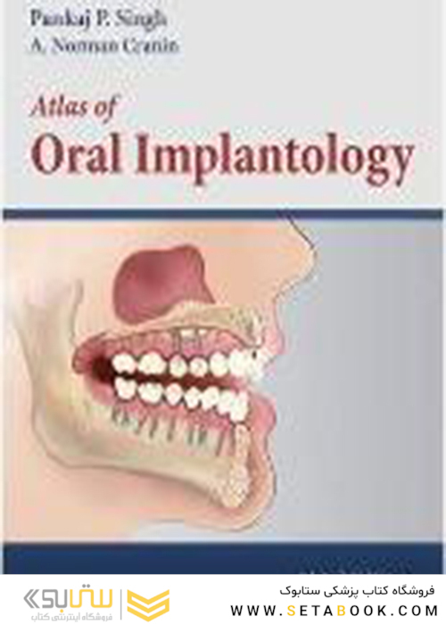 Atlas of Oral Implantology