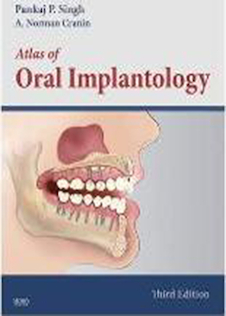 عکس Atlas of Oral Implantology