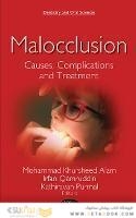 Malocclusion : Causes, Complications and Treatment