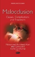 عکس Malocclusion : Causes, Complications and Treatment