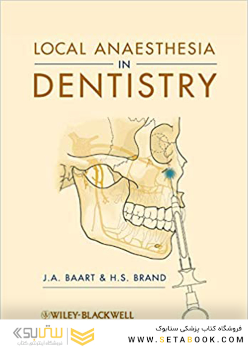 Local Anaesthesia in Dentistry