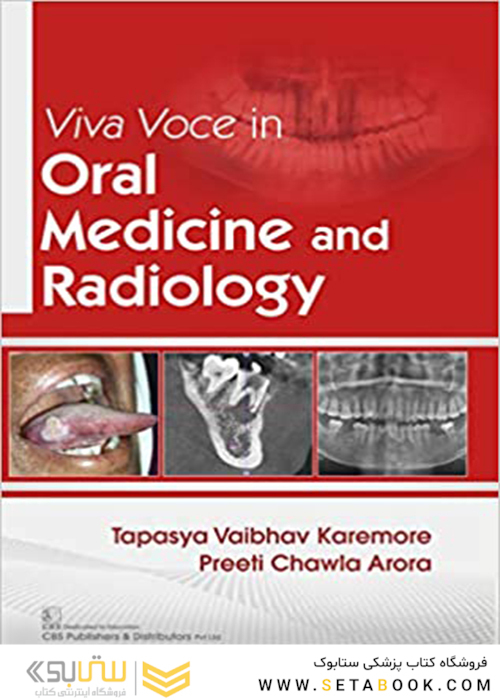 Viva Voce Oral Medicine and Radiology