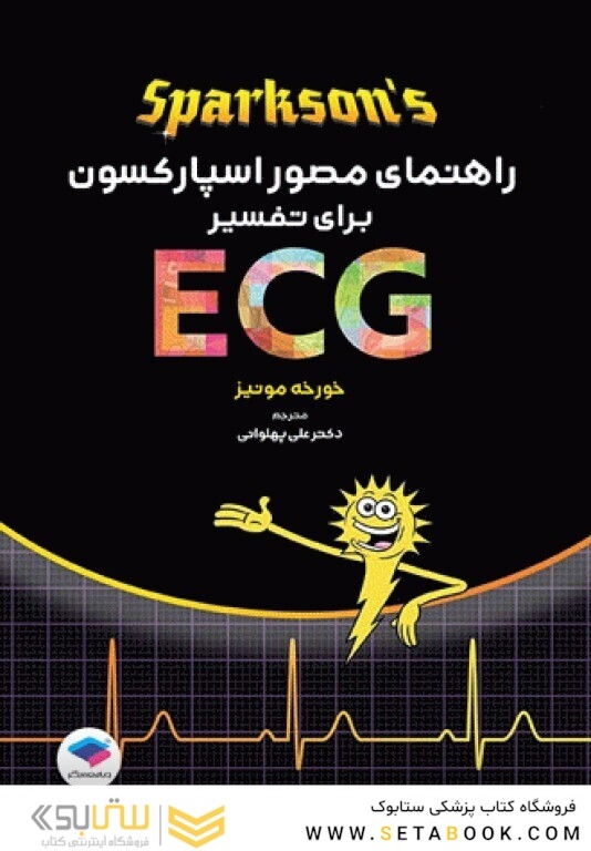 راهنمای مصور اسپارکسون برای تفسیر ECG