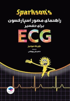 عکس راهنمای مصور اسپارکسون برای تفسیر ECG