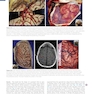 Youmans and Winn Neurological Surgery: 4 - Volume Set 2023