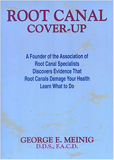 عکس Root Canal Cover Up