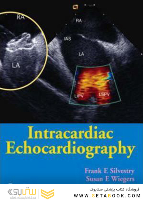 Intracardiac Echocardiography