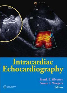 عکس Intracardiac Echocardiography