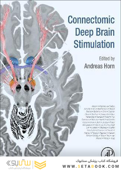 Connectomic Deep Brain Stimulation