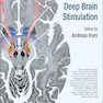 Connectomic Deep Brain Stimulation