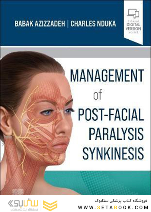 Management of Post-Facial Paralysis Synkinesis