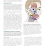 Management of Post-Facial Paralysis Synkinesis
