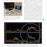 Management of Post-Facial Paralysis Synkinesis