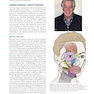 Management of Post-Facial Paralysis Synkinesis