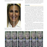 Management of Post-Facial Paralysis Synkinesis