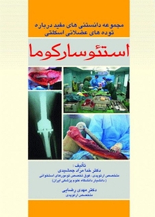 عکس استئوسارکوما(مجموعه دانستنی های مفید درباره توده های عضلانی اسکلتی)