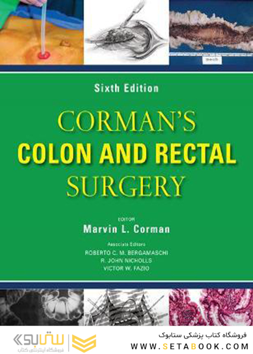 Corman