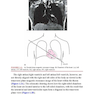 Marriott’s Practical Electrocardiography 13th