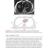 Marriott’s Practical Electrocardiography 13th