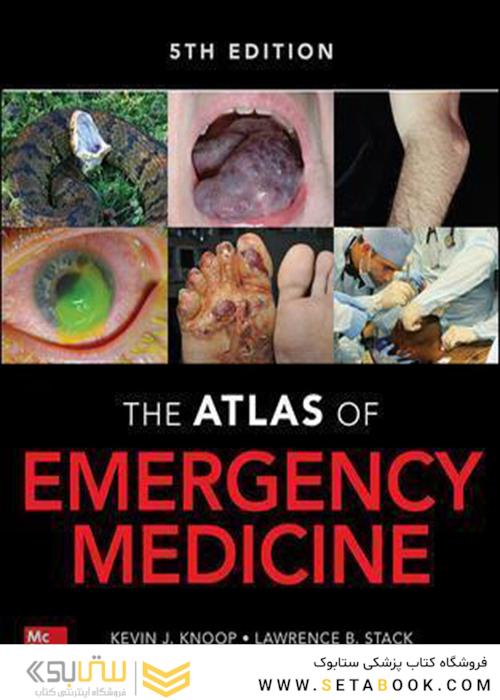 Atlas of Emergency Medicine 5th Edition 5th Edition 2021