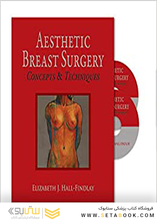 Aesthetic Breast Surgery Concepts - Techniques 1th + video