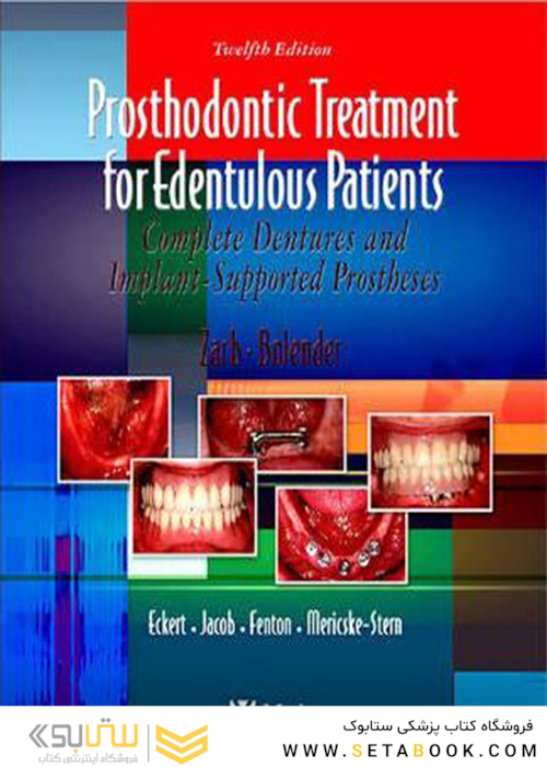 Prosthodontic Treatment for Edentulous Patients