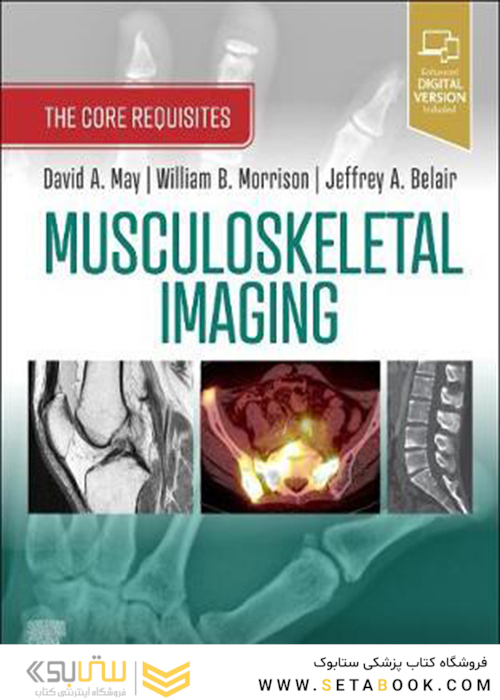 Musculoskeletal Imaging : The Core Requisites