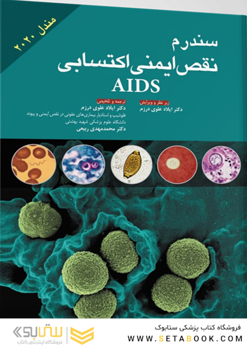 سندرم نقص ایمنی اکتسابی AIDS  مندل 2020