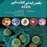 سندرم نقص ایمنی اکتسابی AIDS  مندل 2020